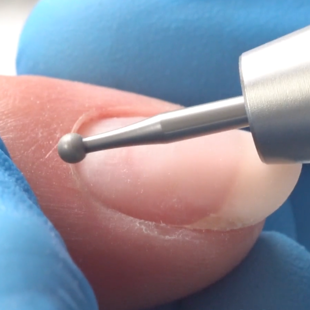 Ball Bit – Erica's ATA