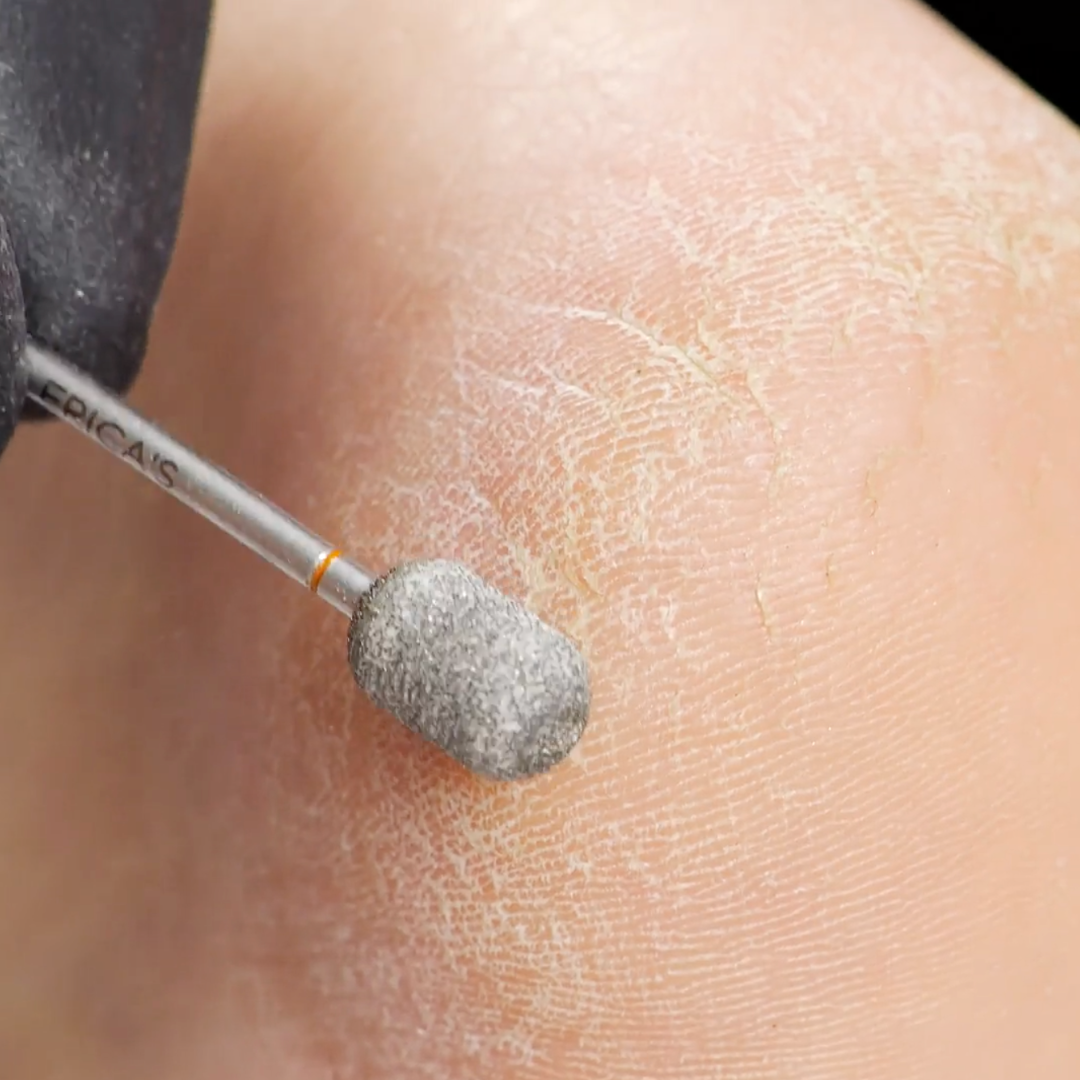 Torch - Pedicure Nail Bit for Callus Exfoliation – Erica's ATA
